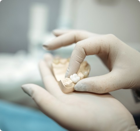 Hand of a dentist holding a dental impression